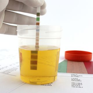 Barrera natural contra infecciones